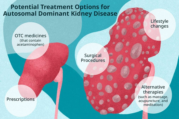 Treatment For kidney Disease